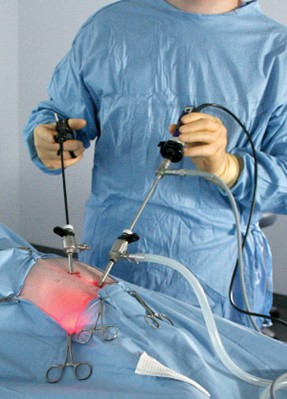 Laparoscopic Spay